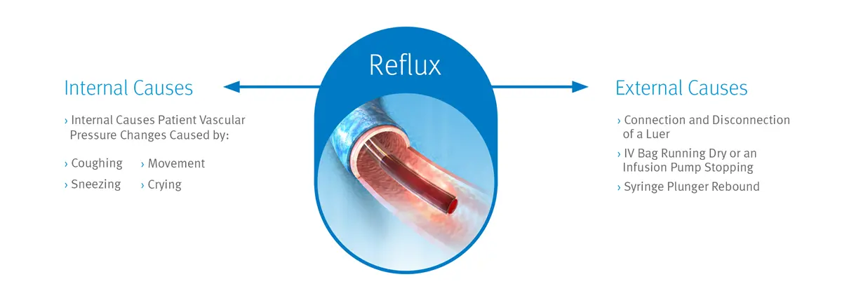 ICU Medicals Neutron Reflux diagram